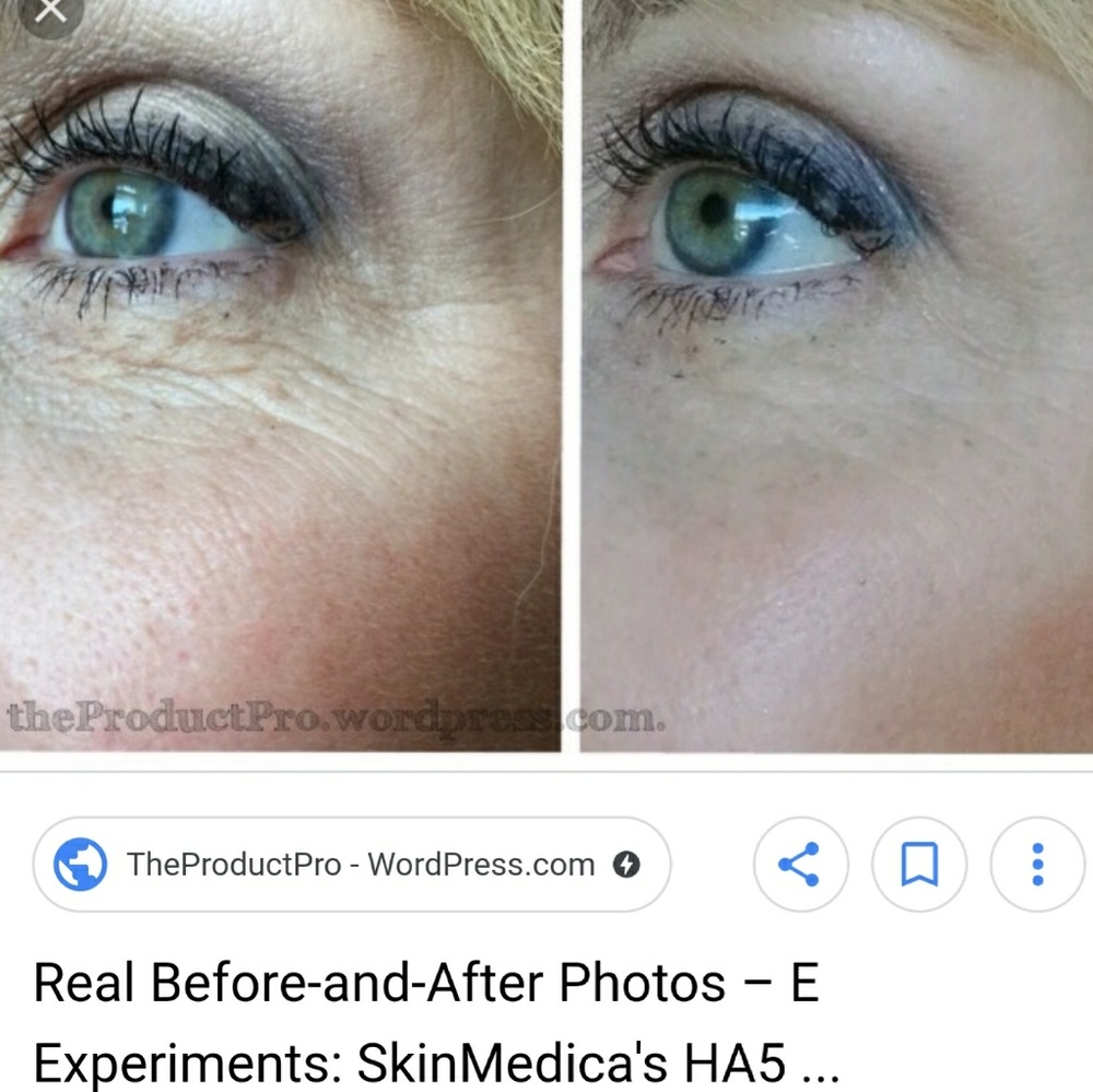 Skin Medica HA5 Hydrator 1oz